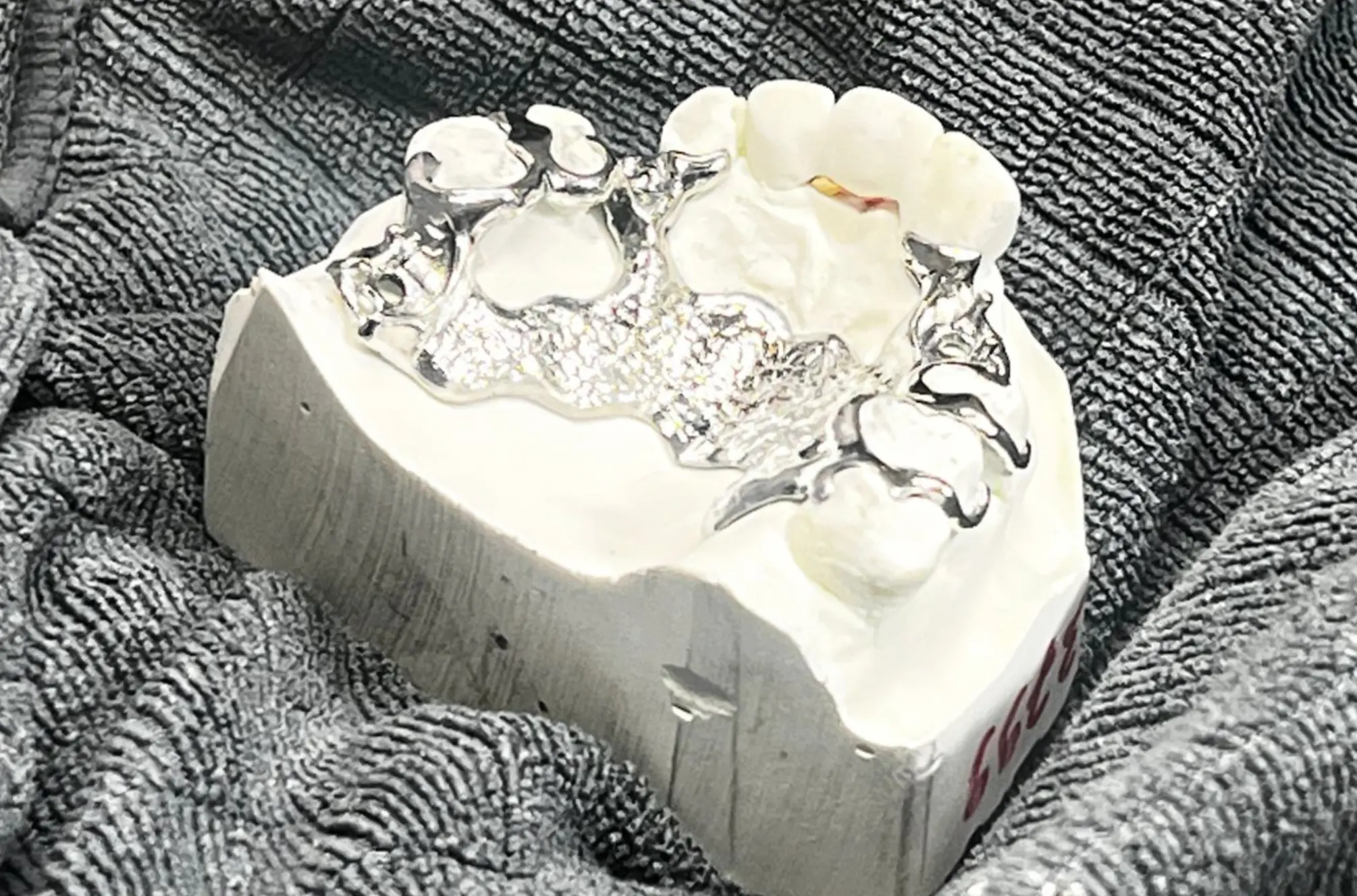 Oberkiefer-Modellguss – Ihre verlängerte Werkbank für Dentallabore in Bregenz, Dornbirn & Feldkirch Vorarlberg