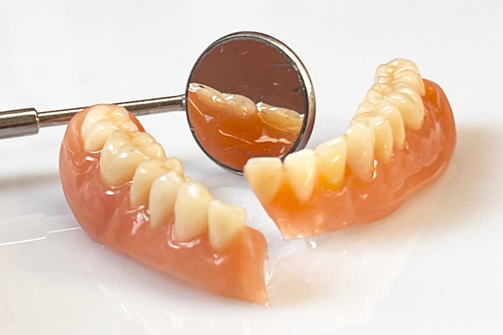 unterkieferprothese gebrochen wien reparatur bruchstelle vorher zahnersatz reparatur