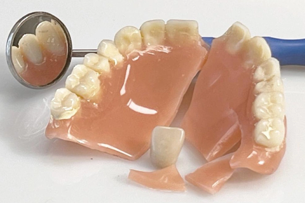 Gebrochene Zahnprothese vor der Reparatur im Dentallabor in Wien