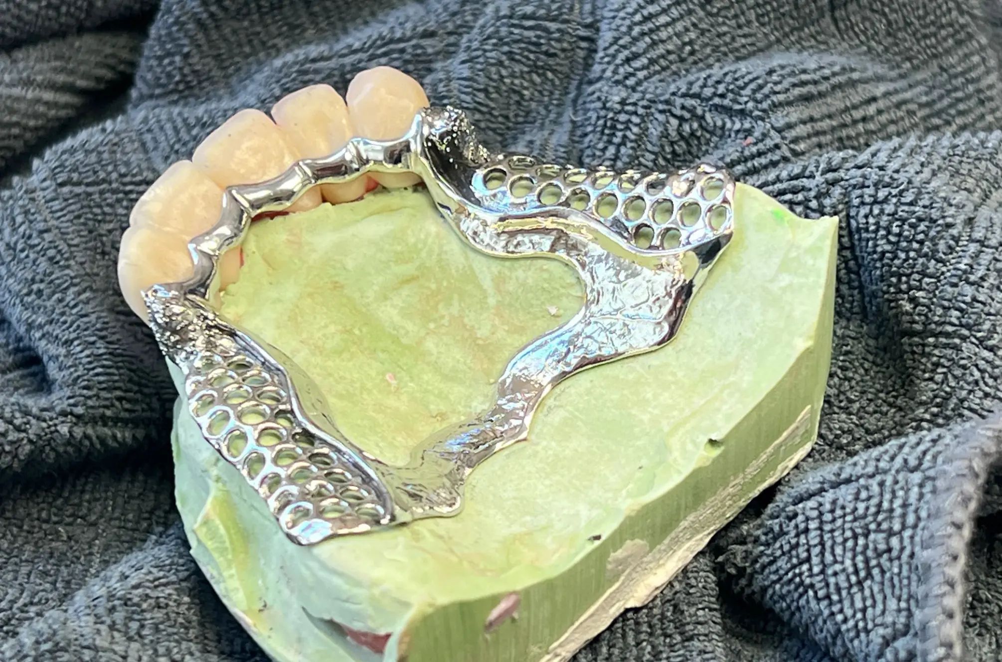 Oberkiefer-Modellguss mit Lochplatte – Ihr Spezialist für analoge Zahntechnik für Labore in Graz & der Steiermark