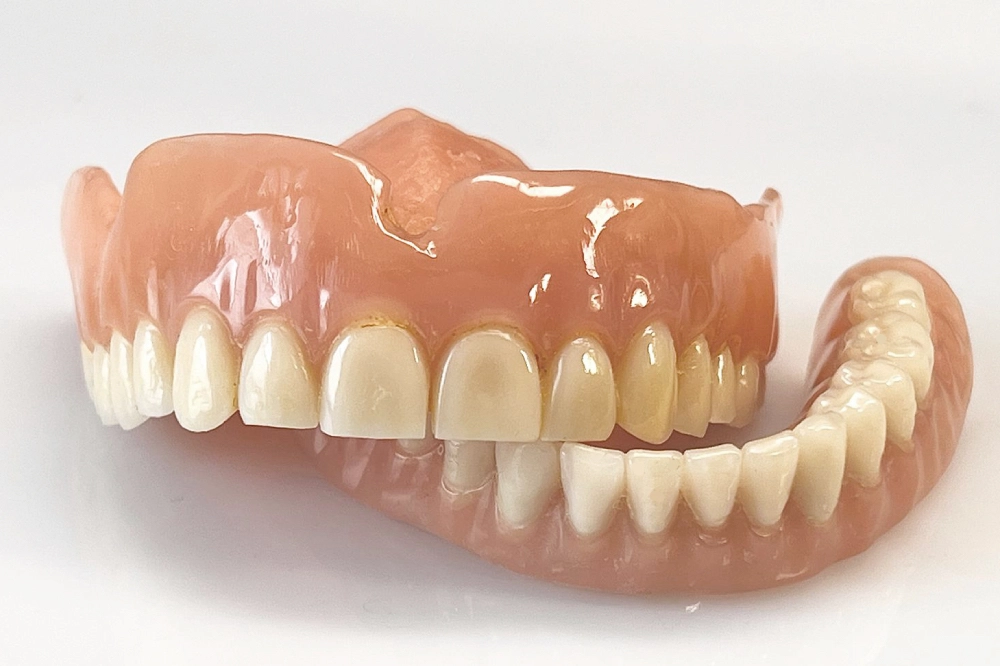 Lockere Zahnprothese Oberkiefer vor Anpassung und Unterfütterung im Dentallabor Wien