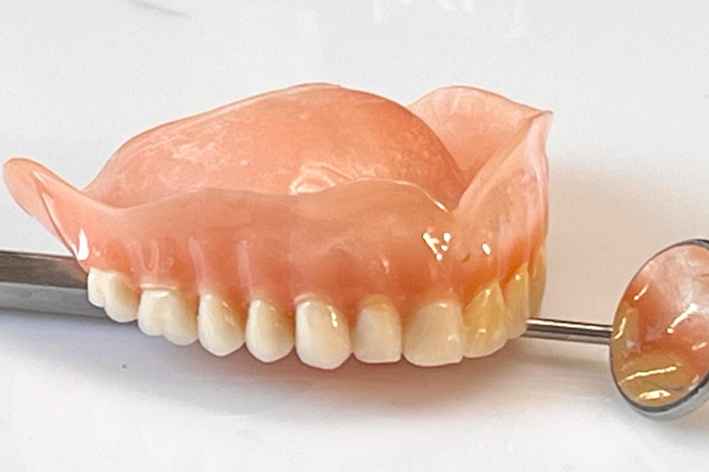 Prothese verursacht Druckstellen und Schmerzen am Zahnfleisch vor Anpassung im Dentallabor Wien