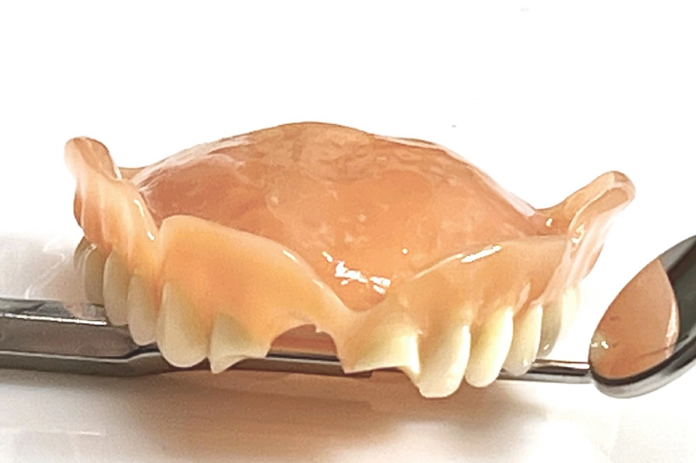 Prothese mit mehreren fehlenden Zähnen vor Reparatur im Dentallabor Wien