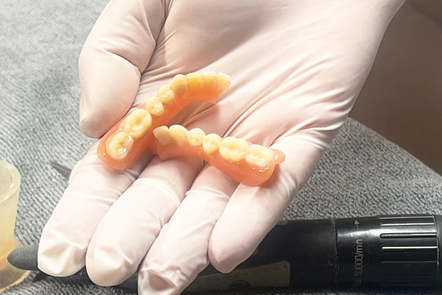 Unterkiefer Prothesenbruch – gebrochene oder gesprungenen Zahnprothese Reparatur Wien