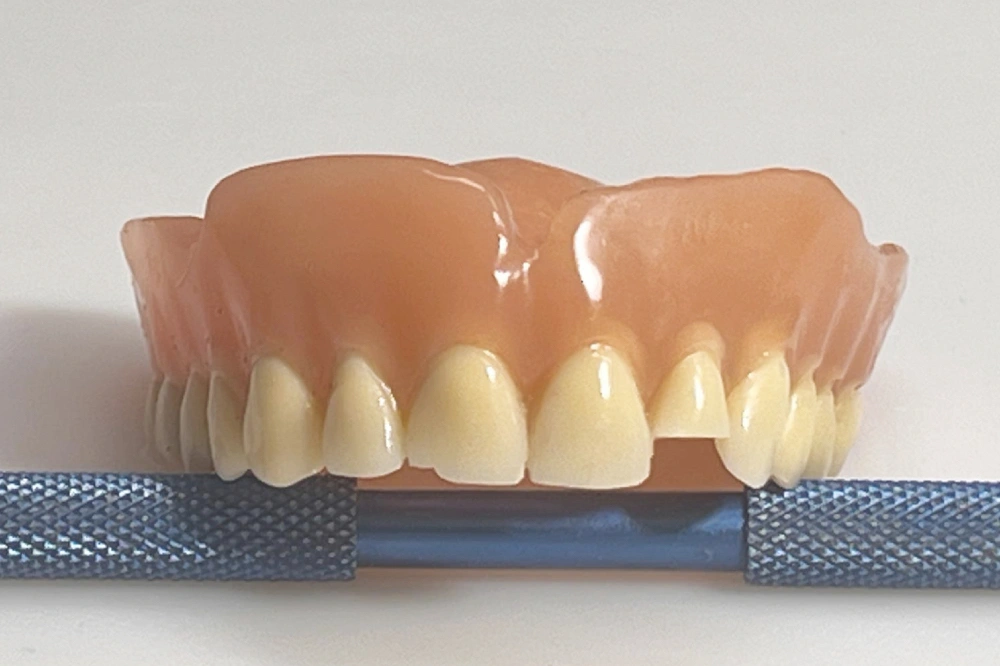 Lockere Zahnprothese Oberkiefer vor Anpassung und Unterfütterung im Dentallabor Wien
