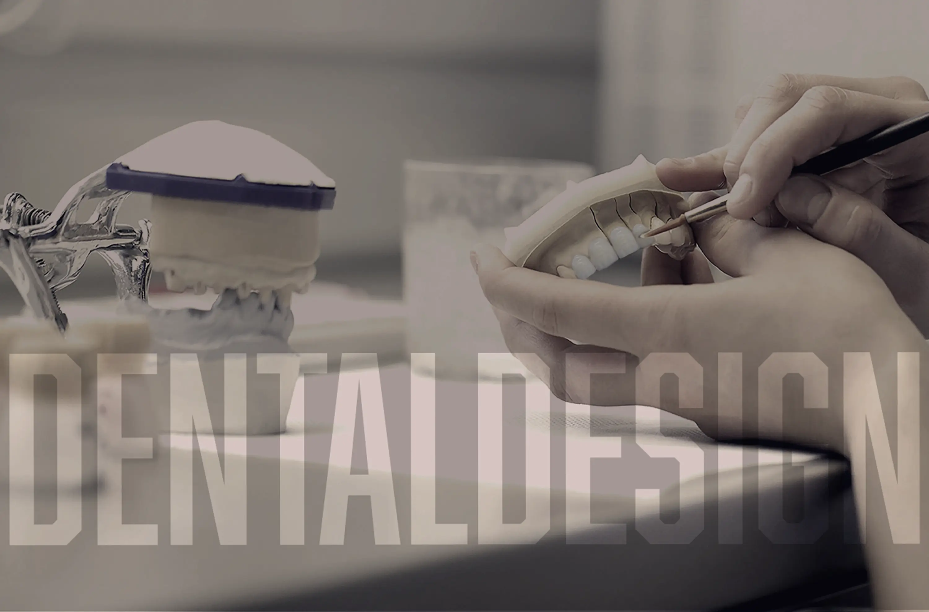 Ganger Dentaldesign Wien – Meisterlabor für analogen Modellguss und Partner für Dentallabore in Österreich