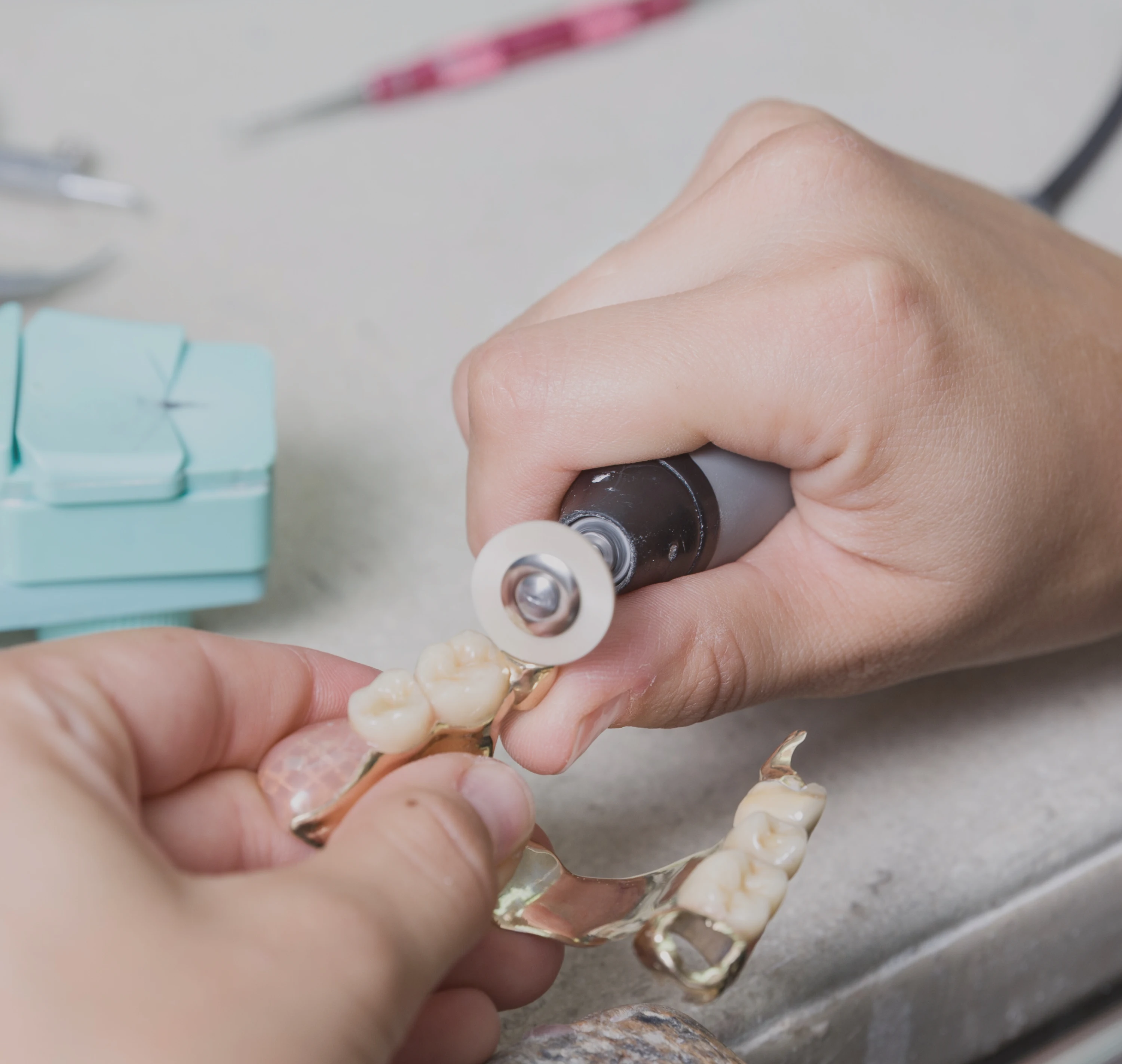 Reparatur einer Zahnprothese im Dentallabor Wien